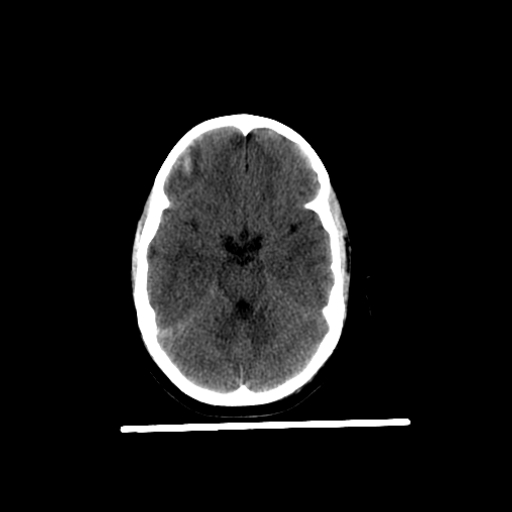 Axial Brain 7 yo-2