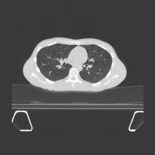 BodyTom 64 Lung A 1-1