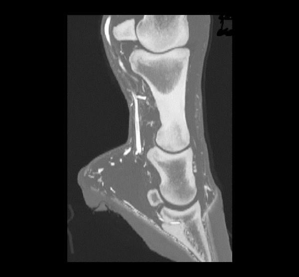 BodyTom Equine Fetlock Bone with Contrast