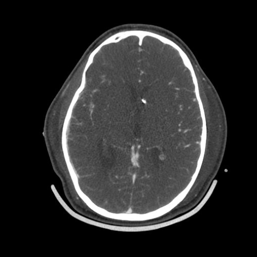 CereTom CTA Axial image-1