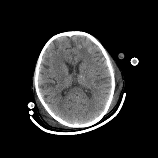 CereTom Pediatric A Axial Brain