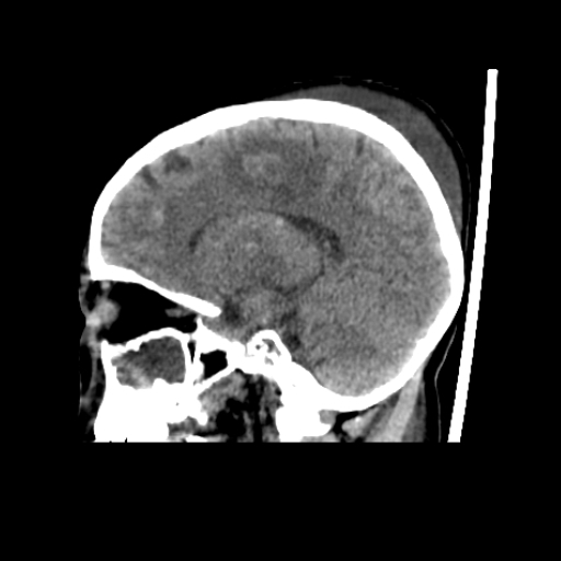 CereTom Pediatric A Sagittal Brain