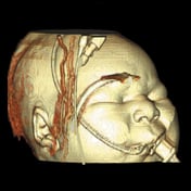 CereTom Pediatric Images