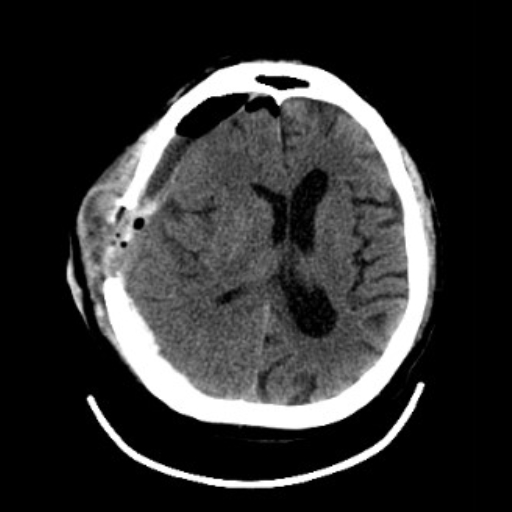 OmniTom Adult Brain 3