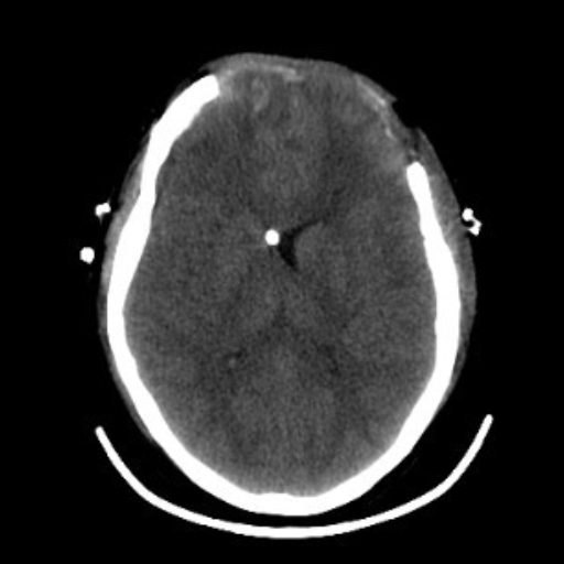 OmniTom Adult Brain