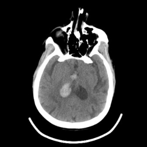 OmniTom Adult Neuro