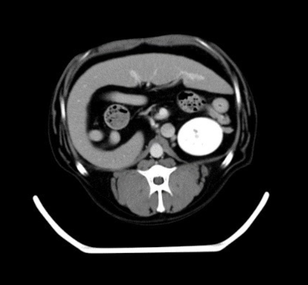 OmniTom Vet Dog Abdomen