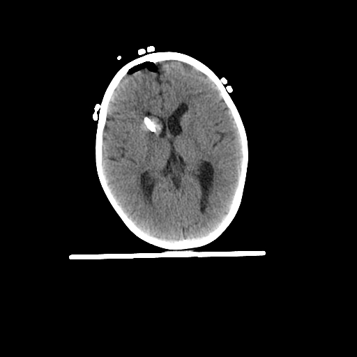 Pediatric 4 yo Brain-4