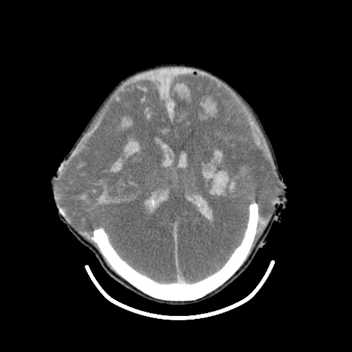 Pediatric Brain-4