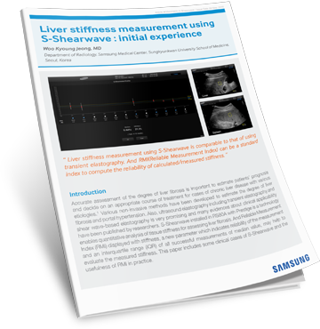 Download Liver Stiffness Case Study