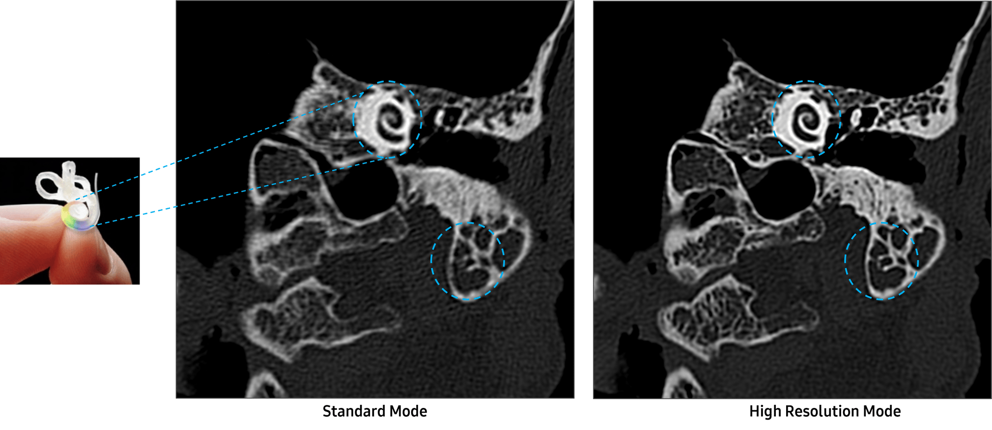 Standard and high resolution comparison-2