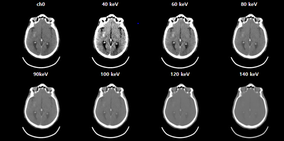 Virtual mono-energtic images