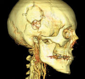 CereTom Neuro Images 