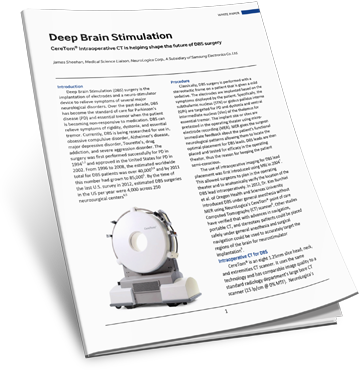 Download the Deep Brain Stimulation White Paper