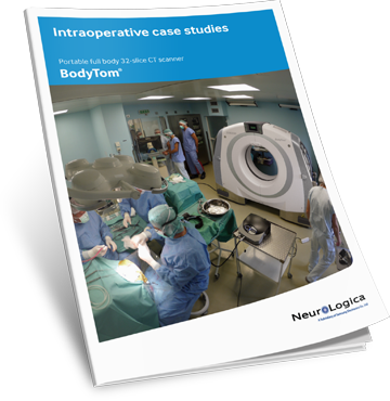 Download the BodyTom Intraoperative CT Case Study
