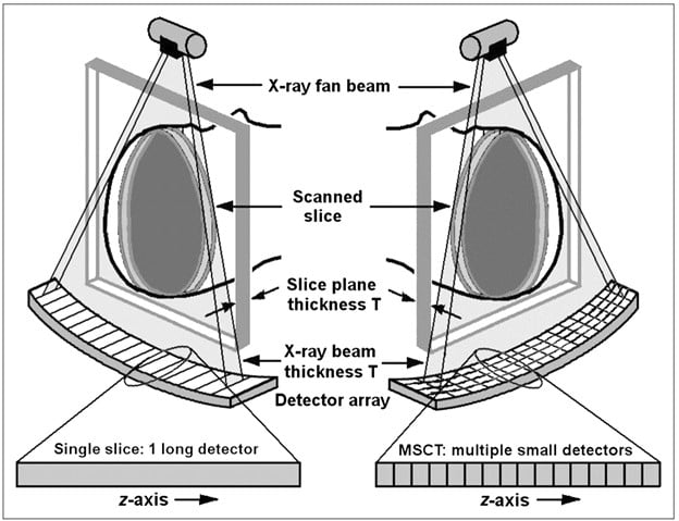 Diagram of a CT scanner slice