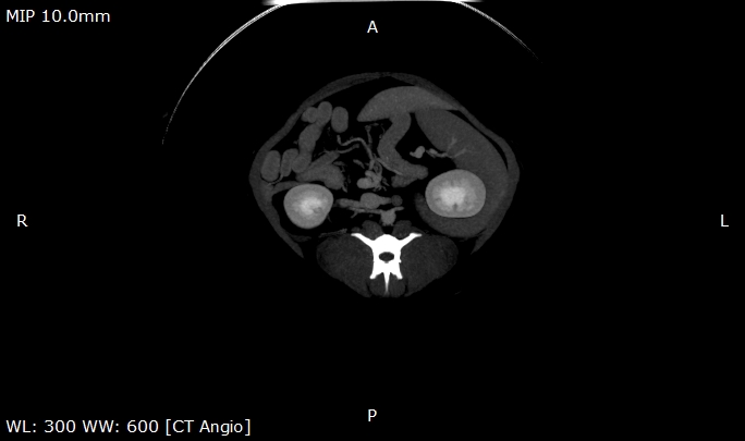 Canine Kidney with Contrast