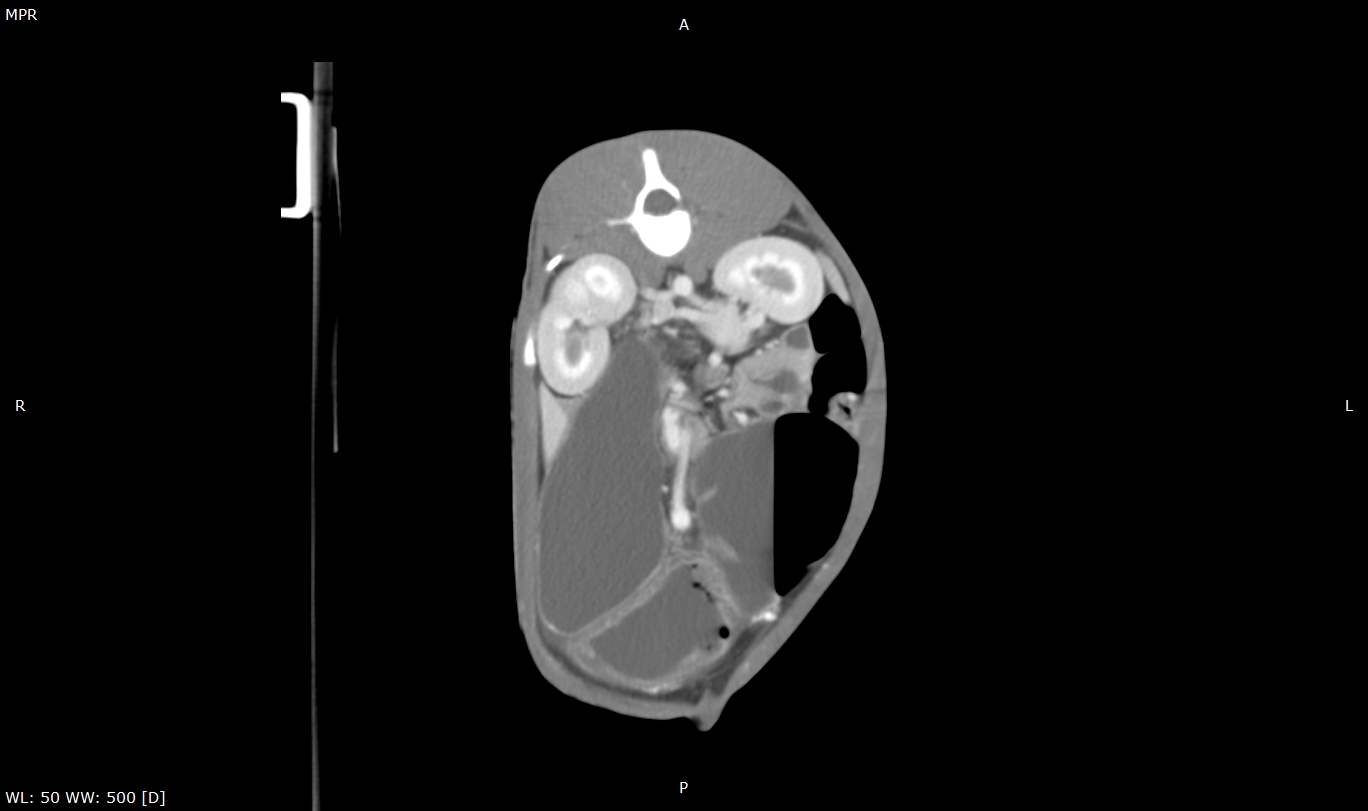 Pig Abdomen with Contrast